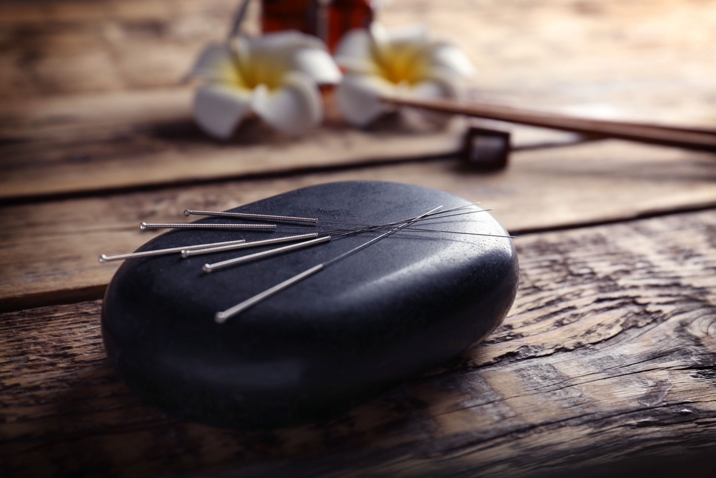 ACUPUNTURE Acupuncture for headache